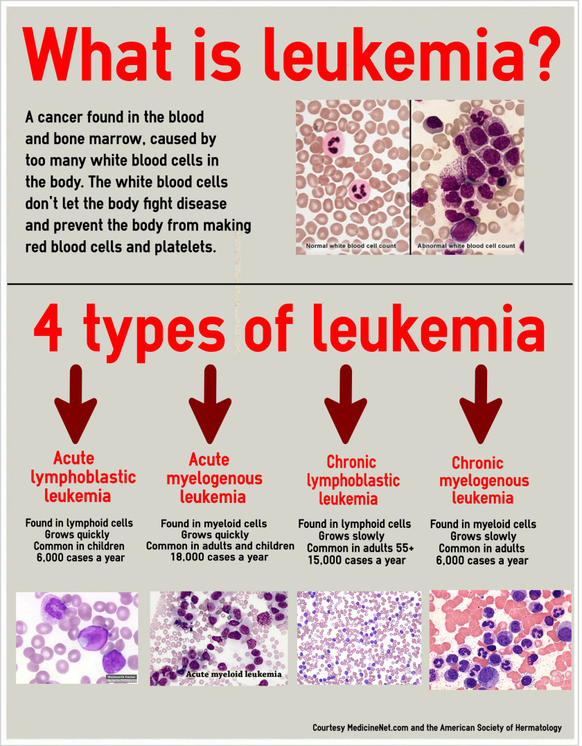 About Leukemia Things Health