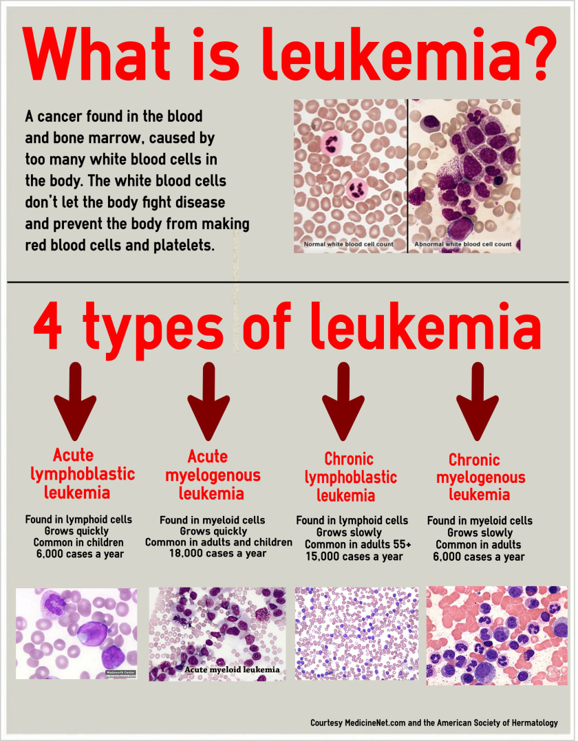 about-leukemia-things-health