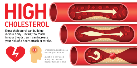 Cholesterol Management Plan | Things Health