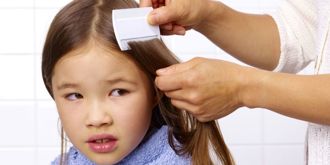 Treating and Preventing a Head Lice Infestation Things Health
