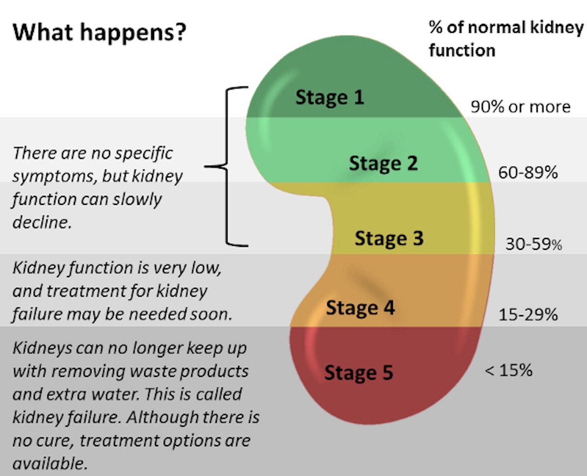 Can Kidney Infection Cause Sickness