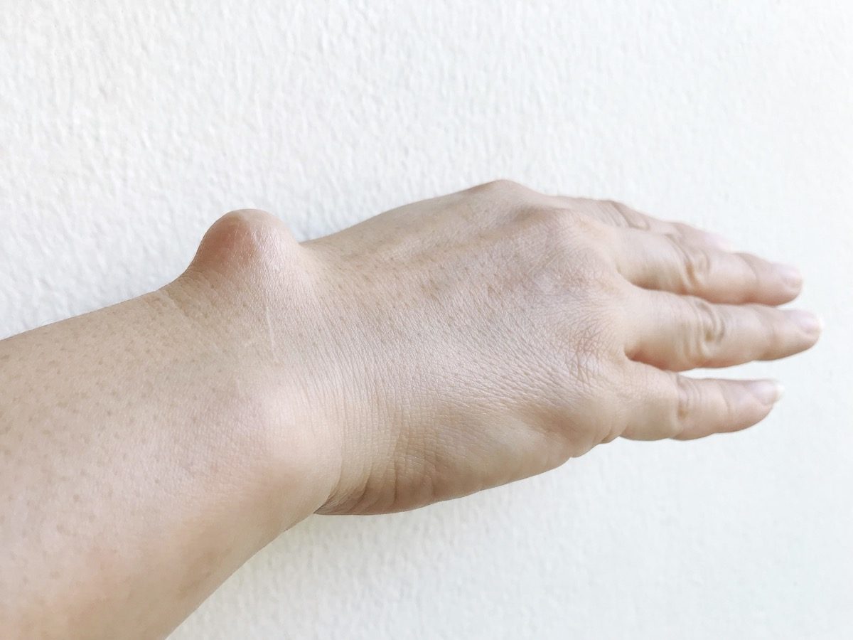 Cancer Symptoms You Should Not Ignore