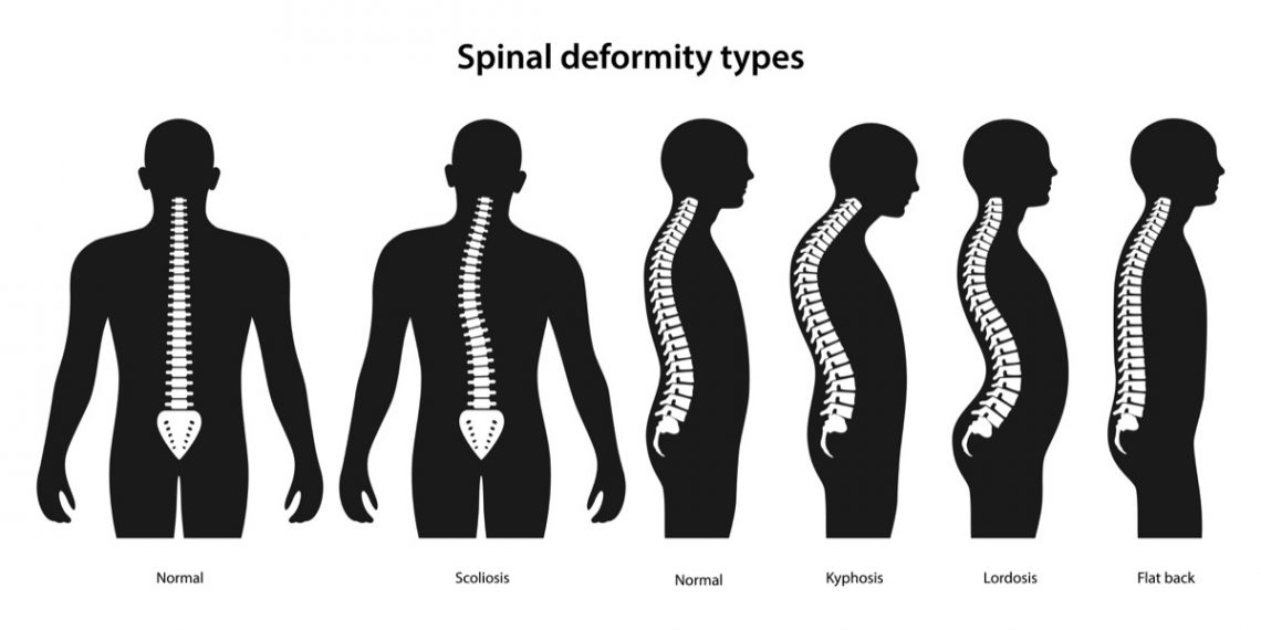 Common Causes of Low Back Pain | Page 8 | Things Health