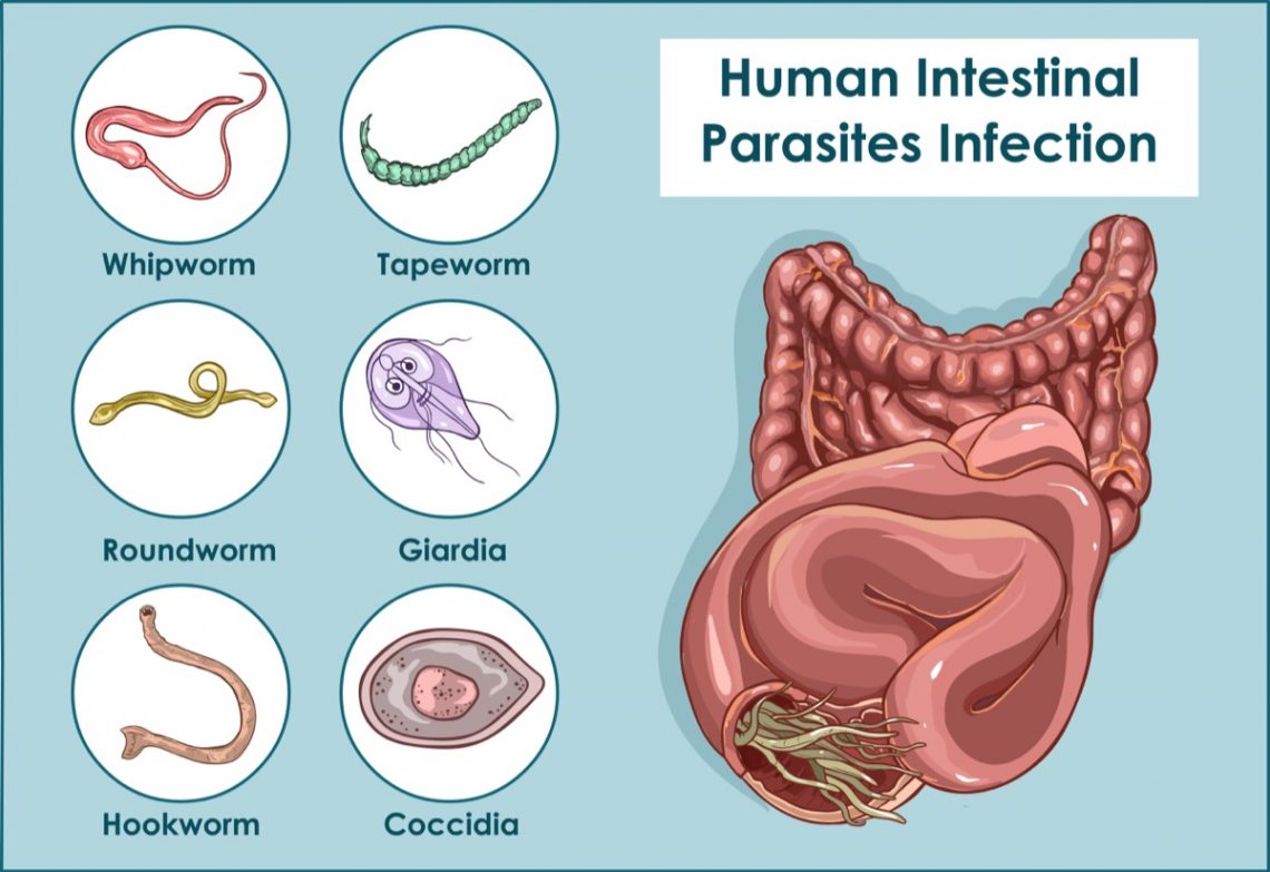 The Common Causes of Stomach Pain | Page 9 | Things Health