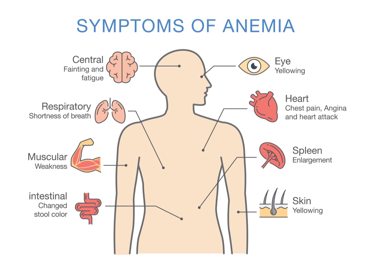 The Causes of Anemia Things Health