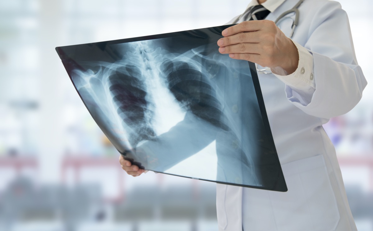 How To Distinguish Between a Cold, Flu and Pneumonia